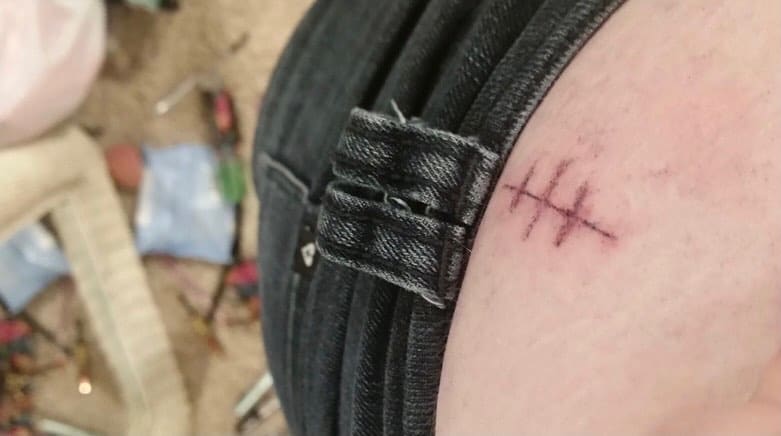 4 cosas que causan cicatrices en los tatuajes
