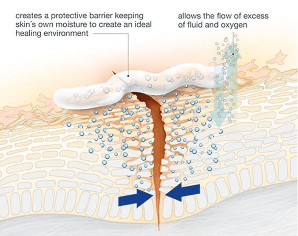 cómo funciona la pomada aquaphor en la piel