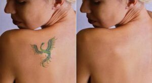 Los pigmentos de tatuajes más fáciles y difíciles de eliminar