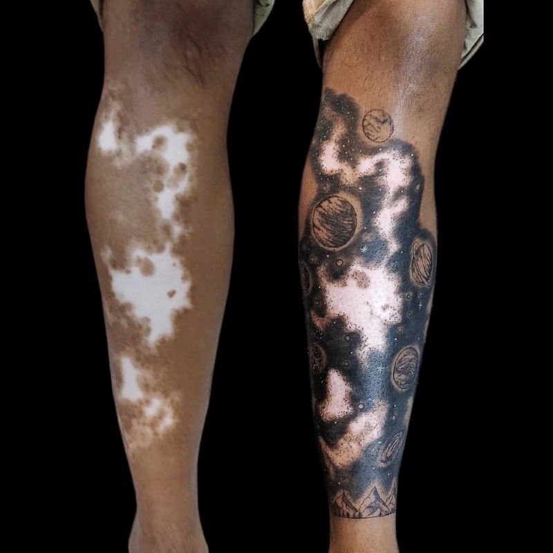 1656857977 608 Vitiligo y tatuajes todo lo que necesitas saber