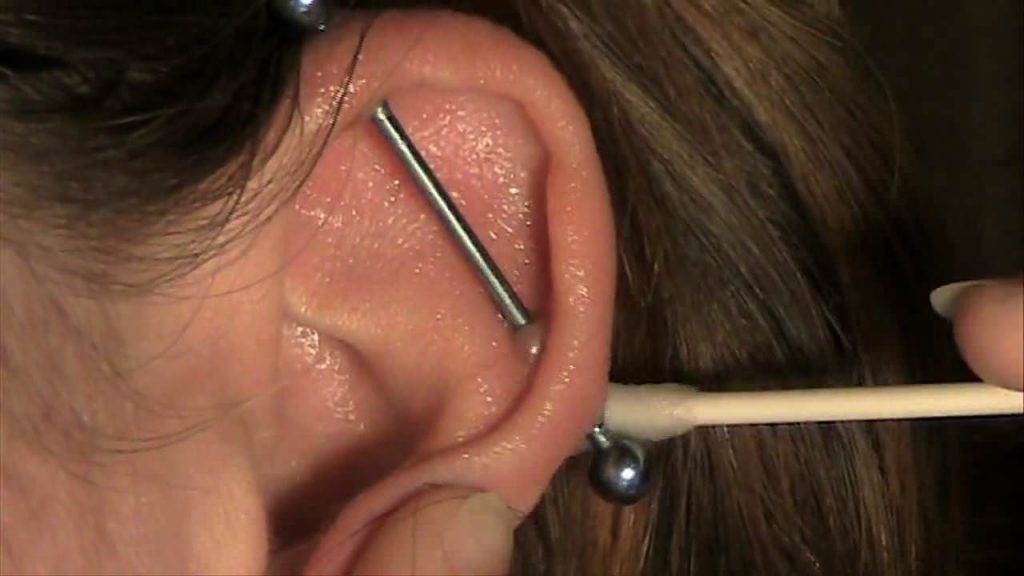 1657227732 269 Piercings de oreja infectados causas y tratamiento