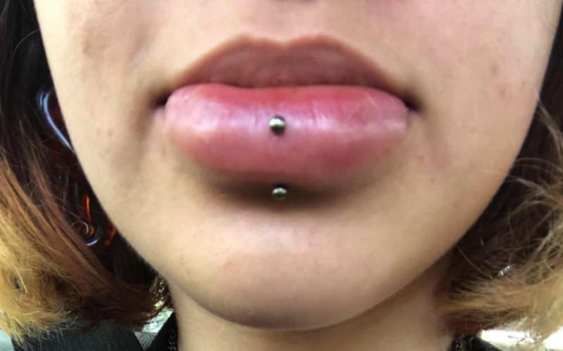 1657267203 lip piercing swelling