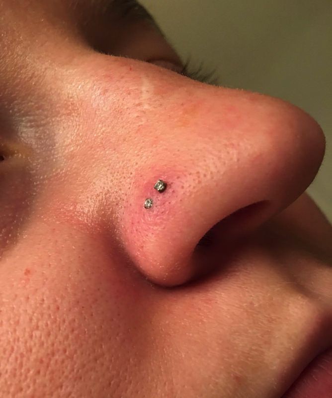 1657410656 nose piercing swelling