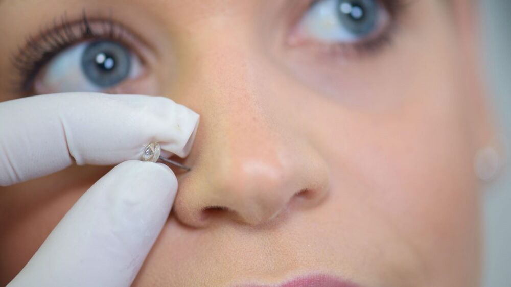 Piercing en la nariz hinchada causas y tratamiento