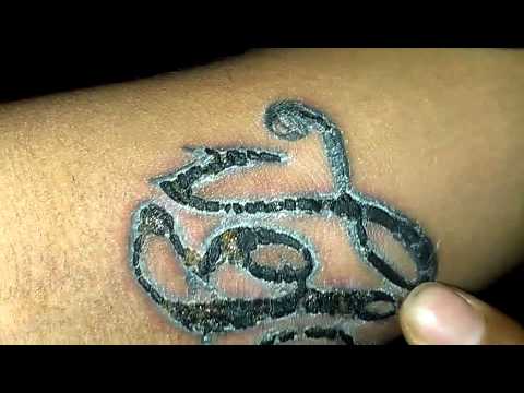 Tattoo Infection Scabbing