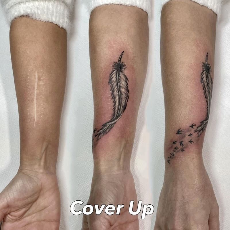 Cicatriz que se oculta con un tatuaje