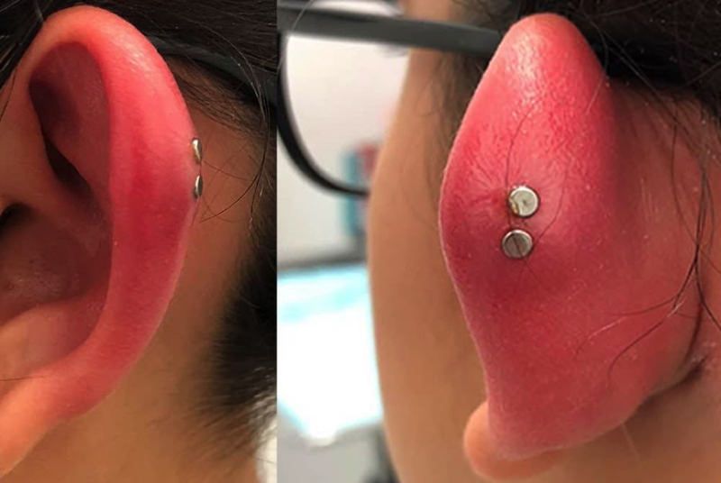 ear piercing swelling