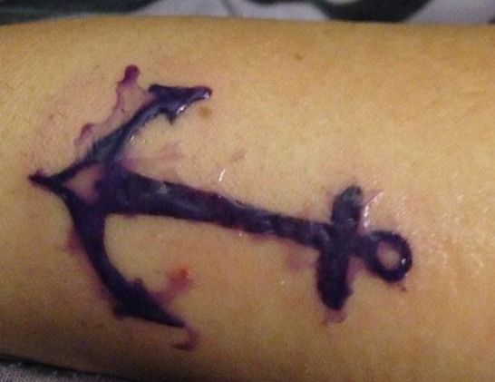 ink leaking from tattoo