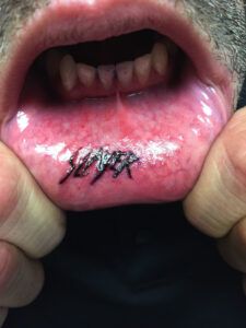 Tatuajes en el interior del labio: 6 pros y contras a tener en cuenta