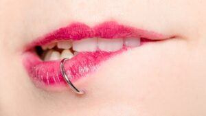 Cicatrices de perforación del labio: causas y tratamiento