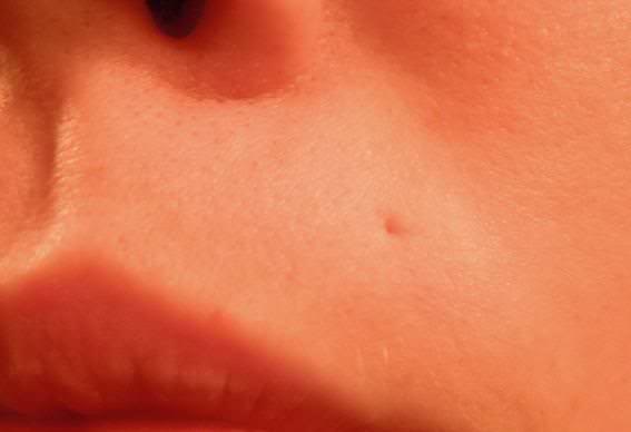 monroe piercing scar