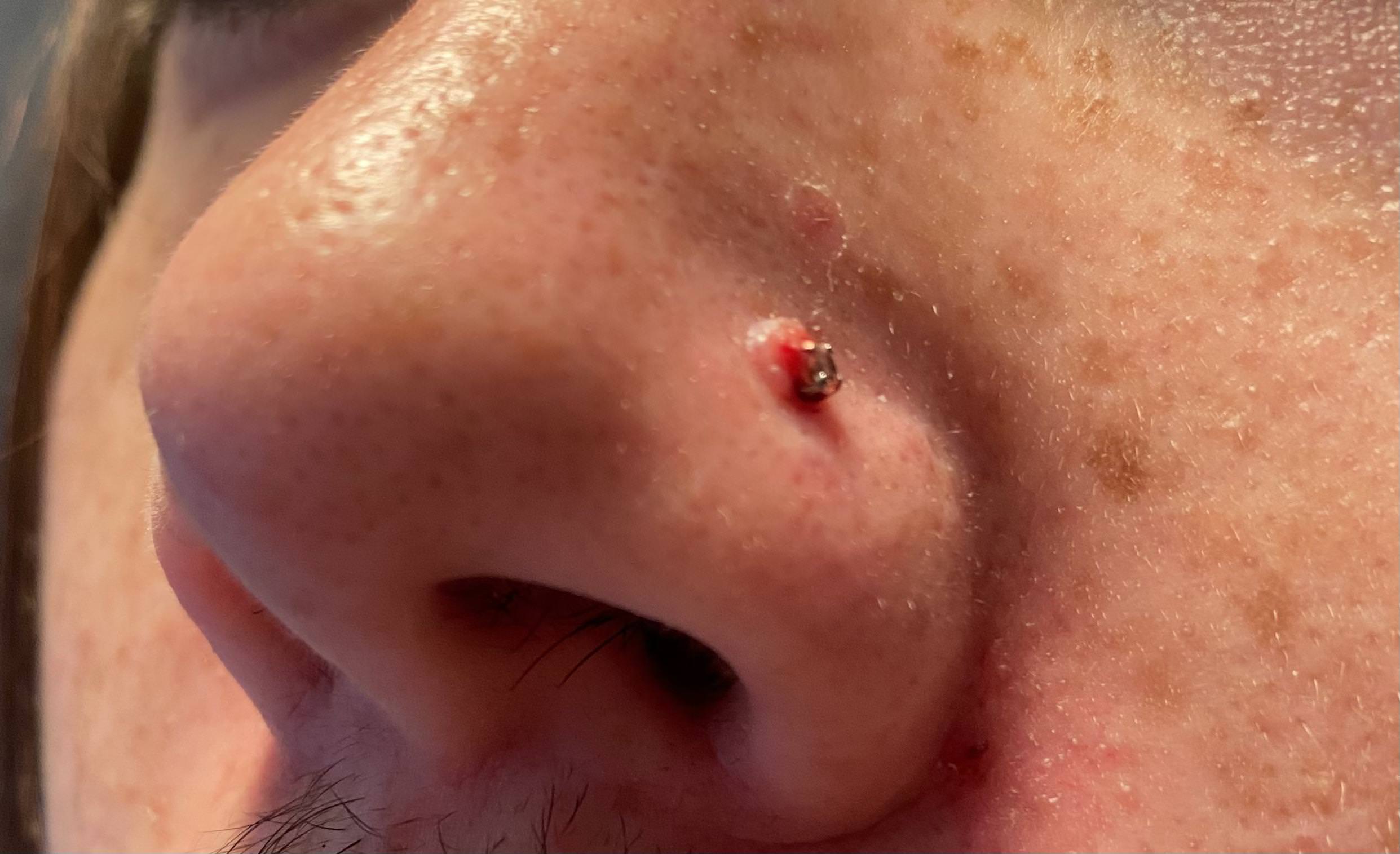nose piercing bleeding