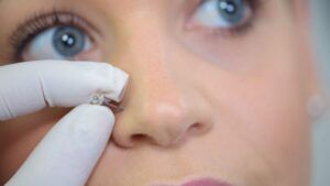 ¿Se puede usar crema anestésica para perforaciones en la nariz?