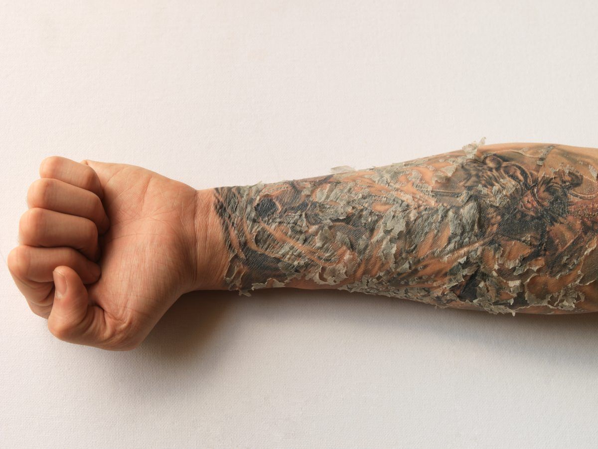 peeling tattoo