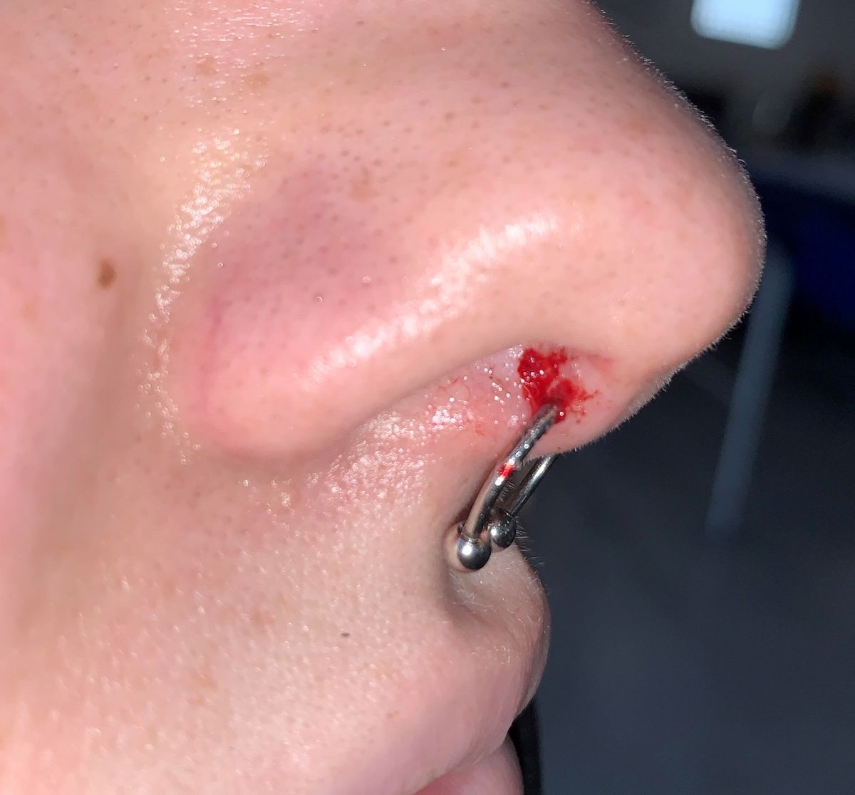 septum piercing bleeding