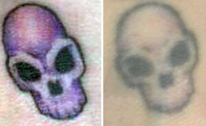 Desvanecimiento del tatuaje: cómo evitar que un tatuaje se desvanezca con el tiempo