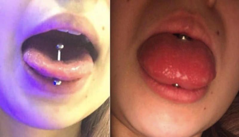tongue piercing swelling