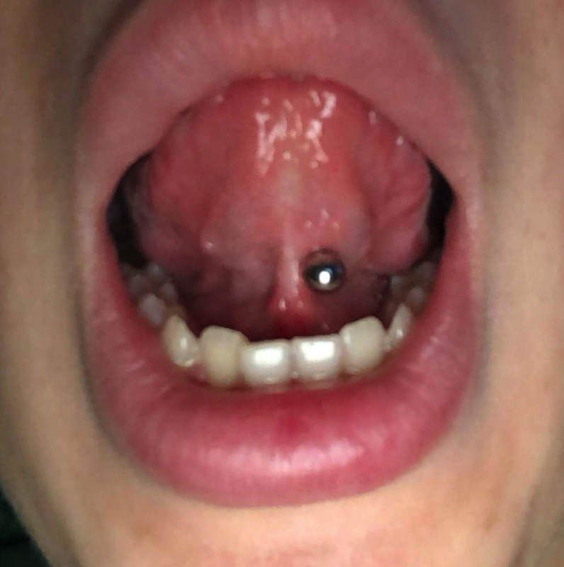 under tongue piercing 2